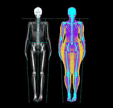 Alt Image